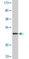 Anti-KIF16B Mouse Monoclonal Antibody [clone: 2B5]