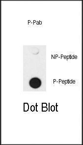 Anti-SMAD4 Rabbit Polyclonal Antibody