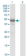 Anti-LHX2 Mouse Monoclonal Antibody [clone: 1E6]