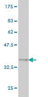 Anti-SSBP3 Mouse Monoclonal Antibody [clone: 3E6]