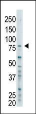 Anti-BAP1 Rabbit Polyclonal Antibody (AP (Alkaline Phosphatase))