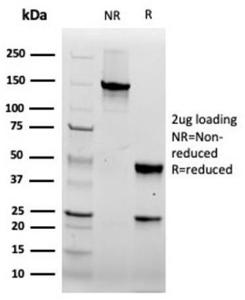 Anti-FABP5 antibody