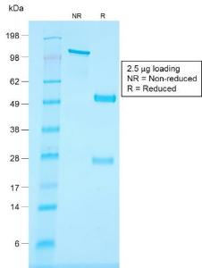 SDS-PAGE analysis of Anti-CD34 Antibody [HPCA1/1806R] under non-reduced and reduced conditions; showing intact IgG and intact heavy and light chains, respectively. SDS-PAGE analysis confirms the integrity and purity of the antibody