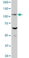 Anti-EVC Mouse Polyclonal Antibody