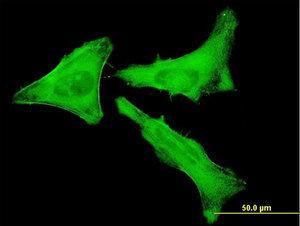 Anti-MYH9 Mouse Monoclonal Antibody [clone: 2B3]