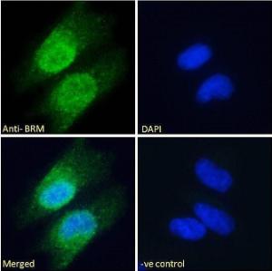 Anti-BRM Antibody (A121174) - Immunofluorescence analysis of paraformaldehyde fixed HeLa cells, permeabilized with 0.15% Triton. Primary incubation 1hr (10µg/ml) followed by Alexa Fluor 488 secondary antibody (2µg/ml), showing predominantly nuclear and some cytoplasmic staining.