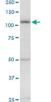 Anti-EVC Mouse Polyclonal Antibody