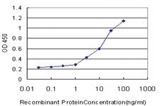 Anti-TEK Mouse Monoclonal Antibody [clone: 5G6]