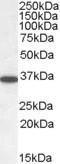 Anti-PPP2CA/PPP2CB Antibody (A82455) (0.05 µg/ml) staining of Human Cerebellum lysate (35 µg protein in RIPA buffer). Primary incubation was 1 hour. Detected by chemilu minescence