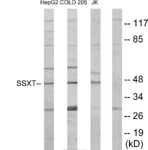 Anti-SS18 Rabbit Polyclonal Antibody