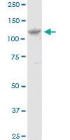 Anti-EVC Mouse Polyclonal Antibody