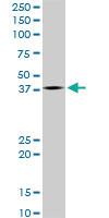 Anti-LHX4 Mouse Monoclonal Antibody [clone: 4D7]