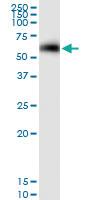 Anti-PMAIP1 Polyclonal Antibody Pair