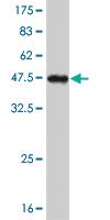 Anti-NKX2-5 Mouse Monoclonal Antibody [clone: 4B11]