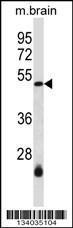 Anti-SMARCB1 Rabbit Polyclonal Antibody (AP (Alkaline Phosphatase))