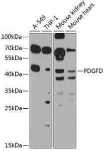 Western blot analysis of extracts of various cell lines, using Anti-SCDGFB/PDGF-D Antibody (A10370) at 1:1,000 dilution