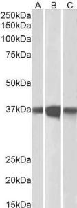 Anti-PPP2CA/PPP2CB Antibody (A82455) (0.1 µg/ml) staining of Mouse (A), Rat (B) and Pig (C) Brain lysates (35 µg protein in RIPA buffer). Primary incubation was 1 hour. Detected by chemilu minescence