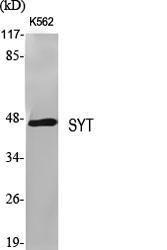 Anti-SS18 Rabbit Polyclonal Antibody