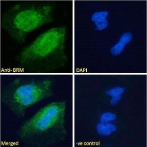 Anti-BRM Antibody (A121174) - Immunofluorescence analysis of paraformaldehyde fixed U251 cells, permeabilized with 0.15% Triton