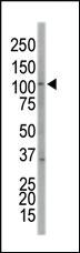 Anti-EPHA7 Rabbit Polyclonal Antibody