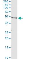 Anti-CD177 Antibody Pair