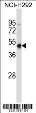 Anti-HOXD3 Rabbit Polyclonal Antibody (Biotin)