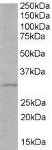 Anti-TIRAP Antibody (A82456) (1µg/ml) staining of Human Liver lysate (35µg protein in RIPA buffer). Primary incubation was 1 hour. Detected by chemiluminescence.