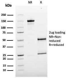 SDS-PAGE analysis of Anti-CD146 Antibody [MCAM/3179] under non-reduced and reduced conditions; showing intact IgG and intact heavy and light chains, respectively. SDS-PAGE analysis confirms the integrity and purity of the antibody.