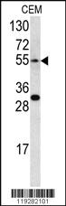 Anti-EDNRA Rabbit Polyclonal Antibody