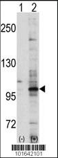 Anti-EPHA7 Rabbit Polyclonal Antibody