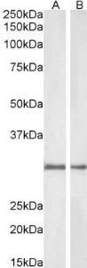 Anti-NQO1 Antibody (A82457) (1µg/ml) staining of Rat (A) and Pig (B) Kidney lysate (35µg protein in RIPA buffer). Detected by chemiluminescence