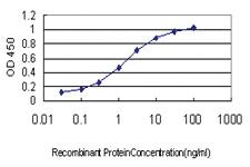 Anti-MECOM Mouse Monoclonal Antibody [clone: 6A9]