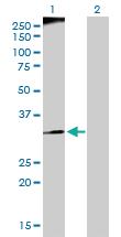 Anti-RFC3 Rabbit Polyclonal Antibody