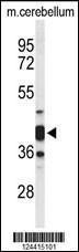 Anti-CYTH3 Rabbit Polyclonal Antibody