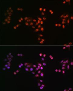 Immunofluorescence analysis of HeLa cells using Anti-Drosha Antibody [ARC0077] (A307542). DAPI was used to stain the cell nuclei (blue)