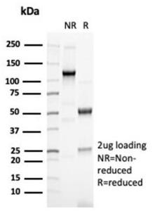 Antibody anti-PAX6 PAX67078R BSA 100 µg