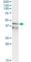 Anti-RFC3 Mouse Monoclonal Antibody [clone: 1C6]