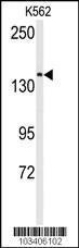 Anti-TRPM7 Rabbit Polyclonal Antibody (APC (Allophycocyanin))