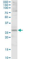 Anti-FOSL1 Mouse Polyclonal Antibody