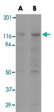 Anti-APAF1 Mouse Monoclonal Antibody [clone: 2E10]