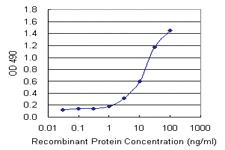 Anti-PARVG Polyclonal Antibody Pair