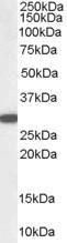 Anti-NQO1 Antibody (A82457) staining (0.03µg/ml) of Human Kidney lysate (RIPA buffer, 35µg total protein per lane). Detected by chemiluminescence.