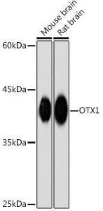 Anti-Otx1 Rabbit Monoclonal Antibody [clone: ARC2264]