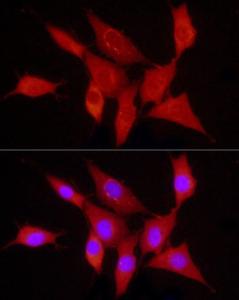 Anti-PDGF B antibody