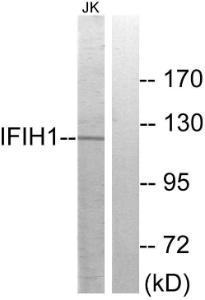 Western blot analysis of lysates from Jurkat cells using Anti-IFIH1 Antibody. The right hand lane represents a negative control, where the antibody is blocked by the immunising peptide