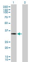 Anti-FOSL1 Mouse Polyclonal Antibody