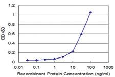 Anti-CLIC3 Mouse Monoclonal Antibody [clone: 2C5]