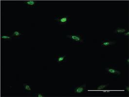 Anti-LHX2 Mouse Monoclonal Antibody [clone: 1E6]