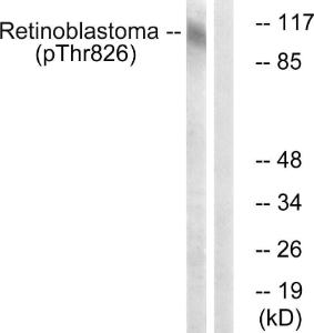 Western blot analysis of lysates from HepG2 cells treated with nocodazole 1 µg/ml 16h using Anti-Retinoblastoma (phospho Thr826) Antibody The right hand lane represents a negative control, where the antibody is blocked by the immunising peptide