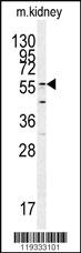 Anti-GADL1 Rabbit Polyclonal Antibody